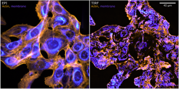 Ultra Large Field of View Super Resolution Microscopy Based on Photonic Chips